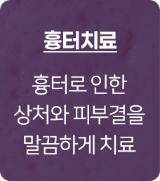 흉터치료, 엑스카, 여드름치료