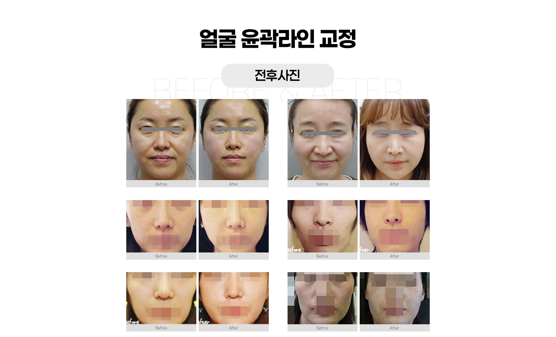 옆광대,윤곽라인