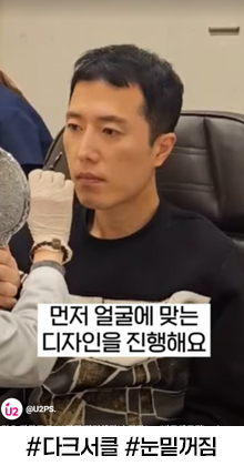 매부리코교정