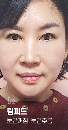 림피드, 다크서클, 눈밑주름, 눈밑지방, 눈밑꺼짐 #shorts