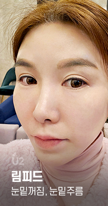 림피드, 다크서클, 눈밑주름, 눈밑지방, 눈밑꺼짐 #shorts