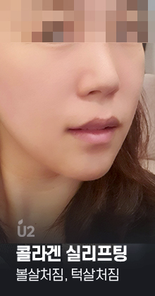 콜라겐실리프팅 #shorts